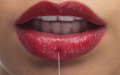 BOTOX® or filler on the lips? What? That’s crazy!
