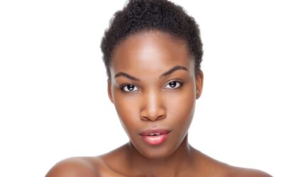 Best Lasers Treatments for Dark Skin Tones