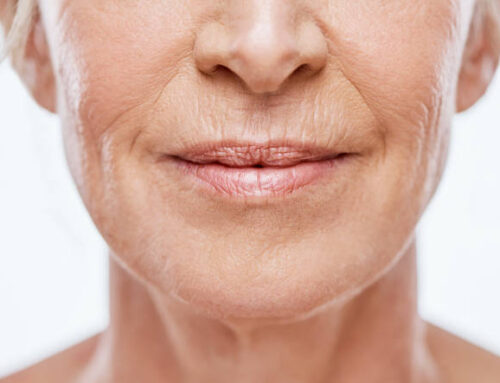 Are Wrinkles Reversible?