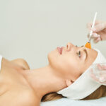 a beginner’s guide to peels