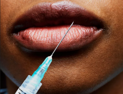 BOTOX® vs. Fillers: Which One Is Better for You?