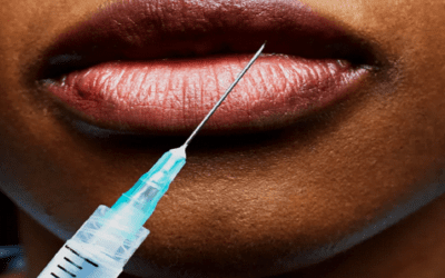 BOTOX® vs. Fillers: Which One Is Better for You?