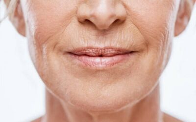 Are Wrinkles Reversible?