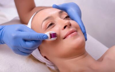 How do dermarollers work?