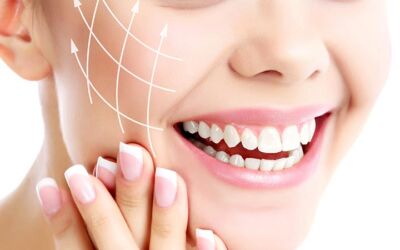 How Can I Get Rid of My Smile Lines?