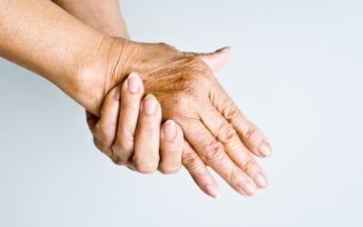 Old Hands: Causes, Prevention, and Treatment
