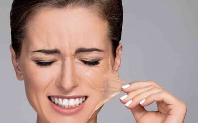 Chemical Peels at Home