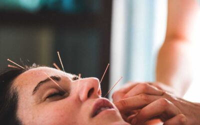 Can Facial Acupuncture Really Make You Look Younger?