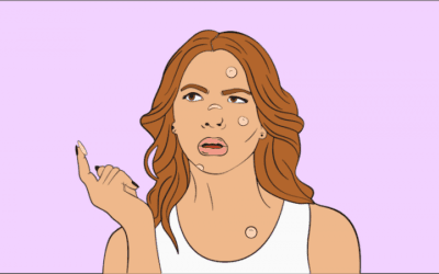 9 Acne Patches to Try