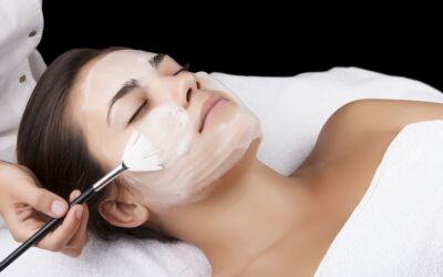 Chemical peels