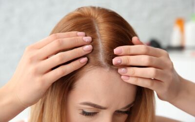 Women’s Hair Loss: Causes, Treatments, and Solutions
