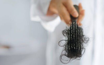 How Much Hair Loss Is Normal?