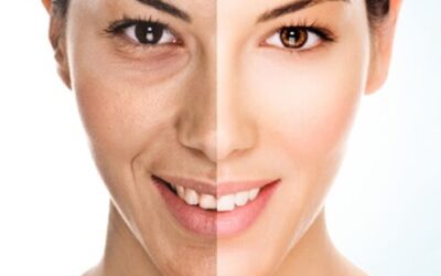 Best Foods for Healthy Skin