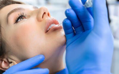 Dermal Fillers for Plumper Lips