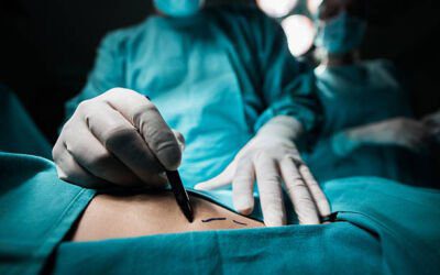 Are the Liposuction Risks Really Bad?