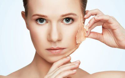 6 Reasons Why People Avoid Silicones in Skin Care