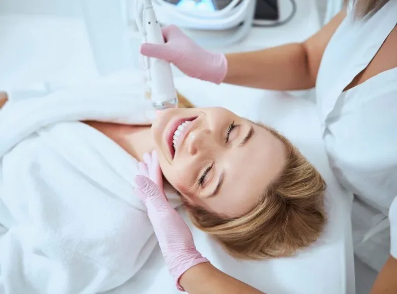 Microneedling 