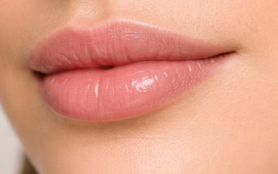 Lip Filler Longevity: How Long Lip Fillers Last