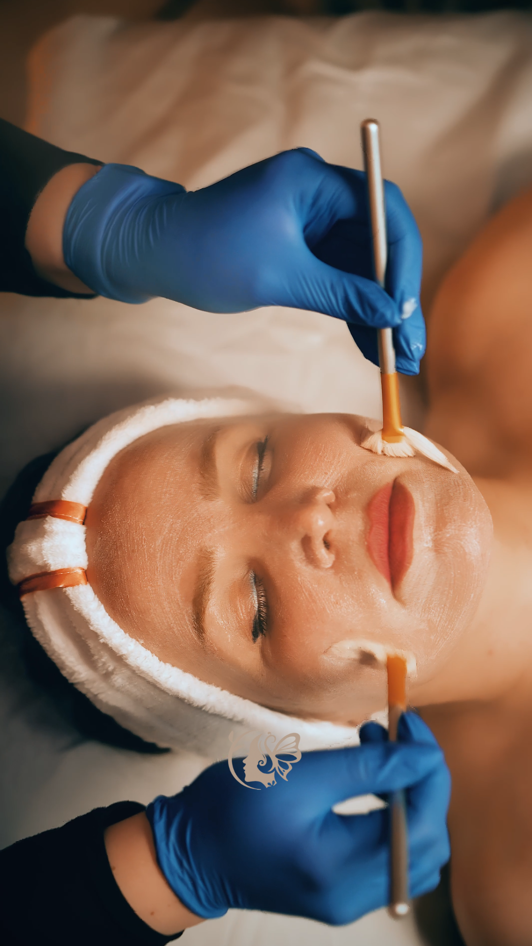 microdermabrasion treatment image