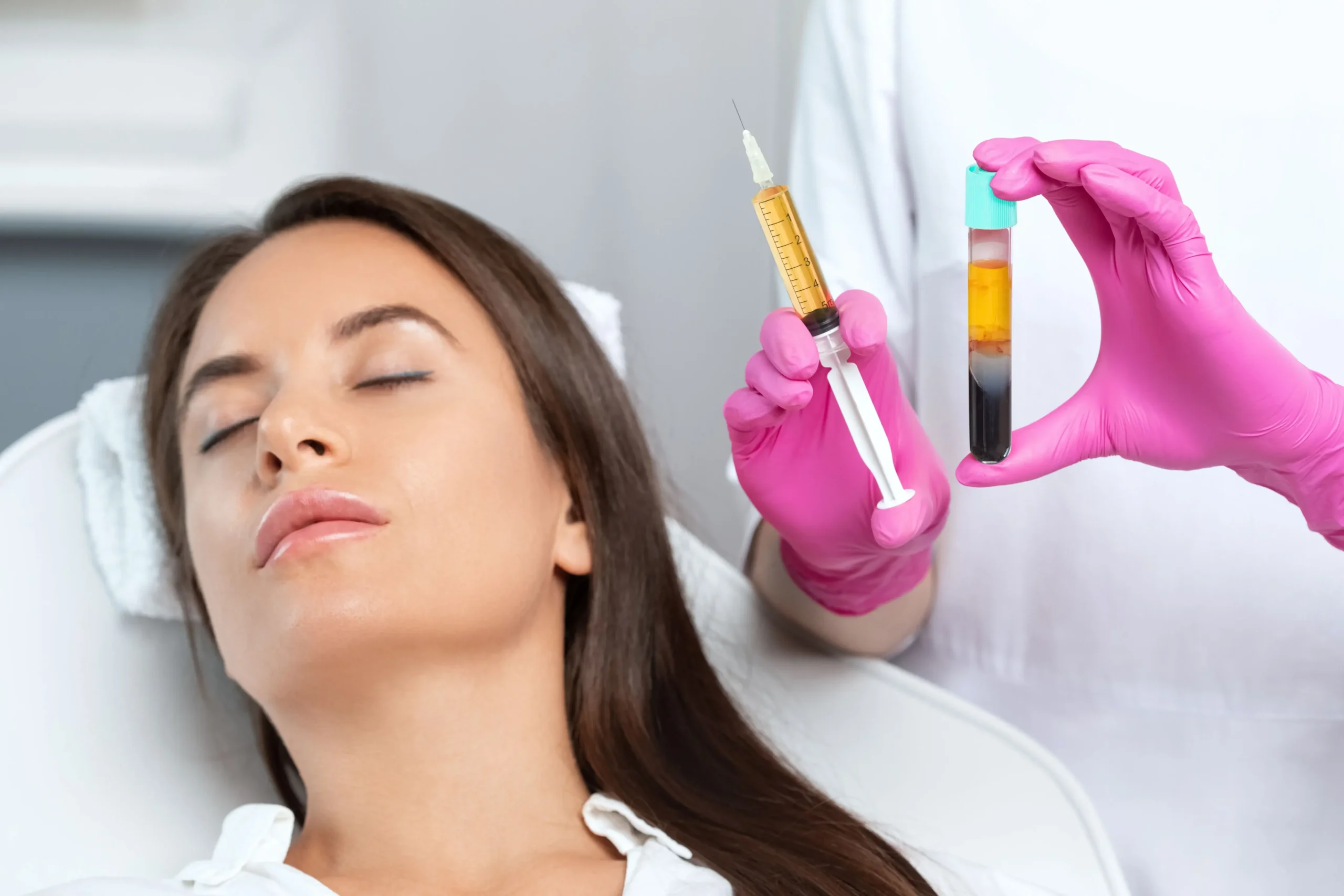 Hair-PRP treatment in Ajax