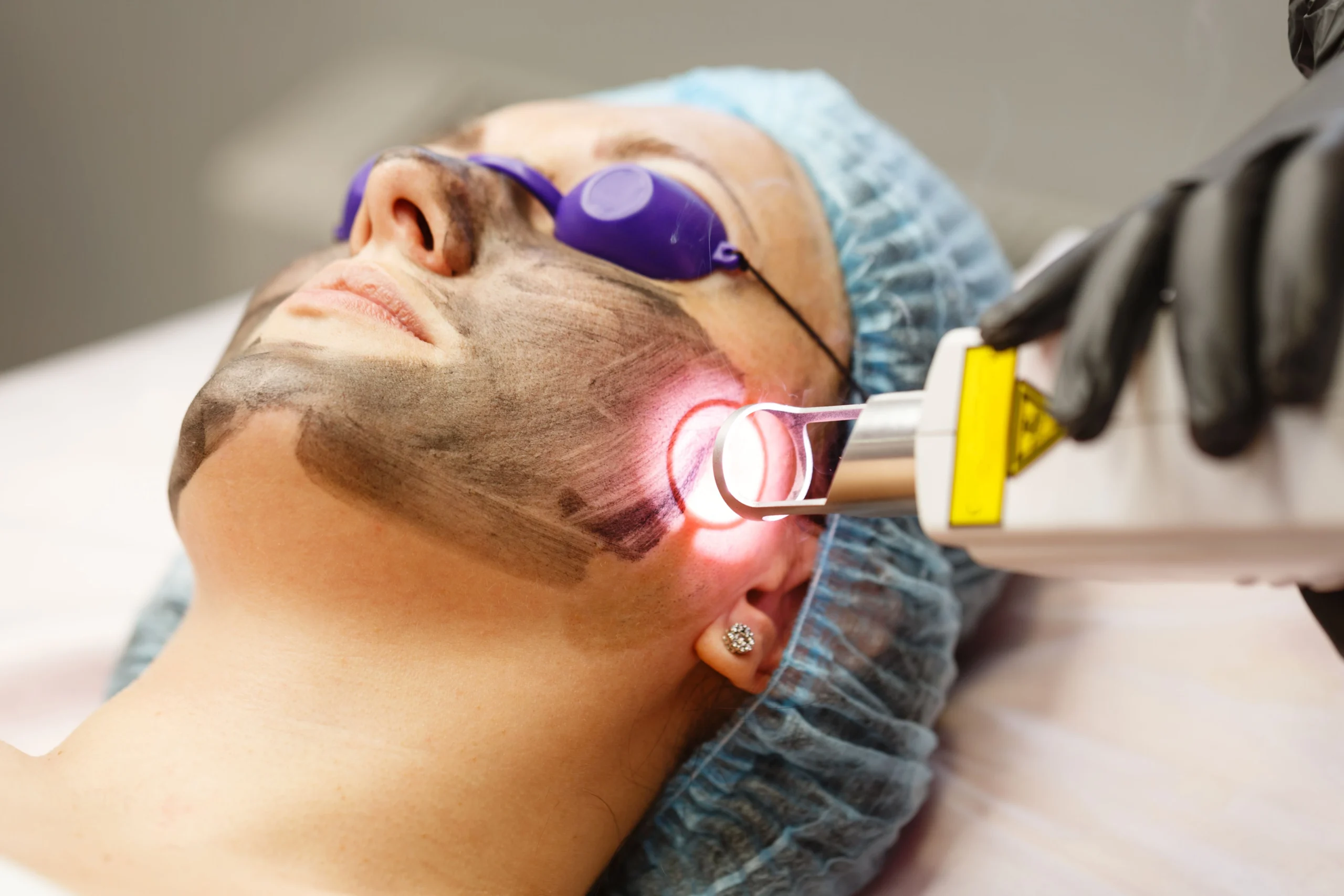 Effective Laser Hair removal Ajax image