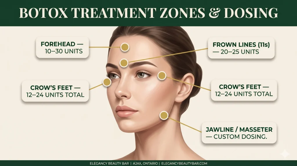 Botox treatments in Ajax dosing map for forehead, frown lines, and crow's feet at Elegancy Beauty Bar