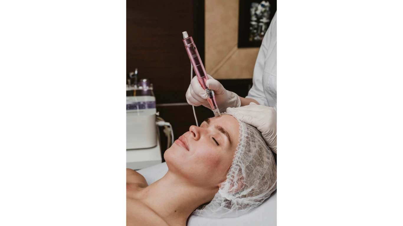 PRP Microneedling