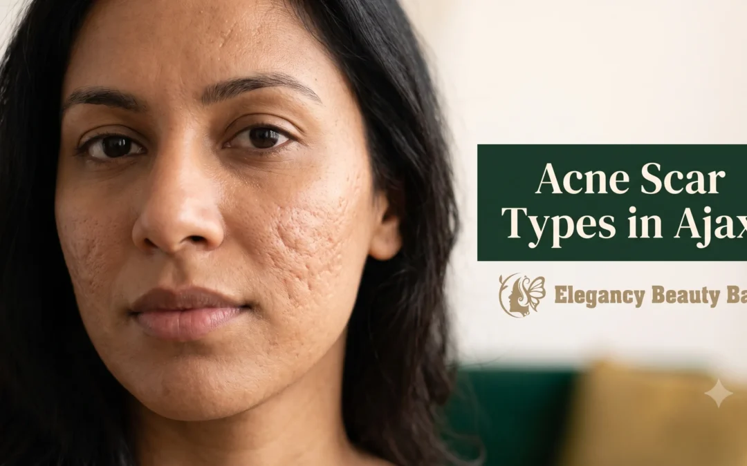 Close-up of acne scar types on skin at Elegancy Beauty Bar in Ajax