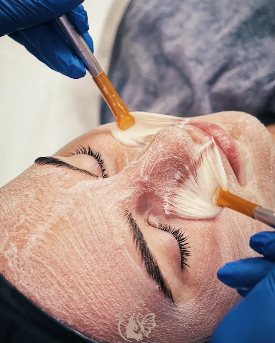 Chemical peel being applied at Elegancy Beauty Bar in Ajax