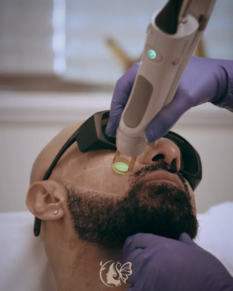 Laser hair removal on a male client at Elegancy Beauty Bar in Ajax